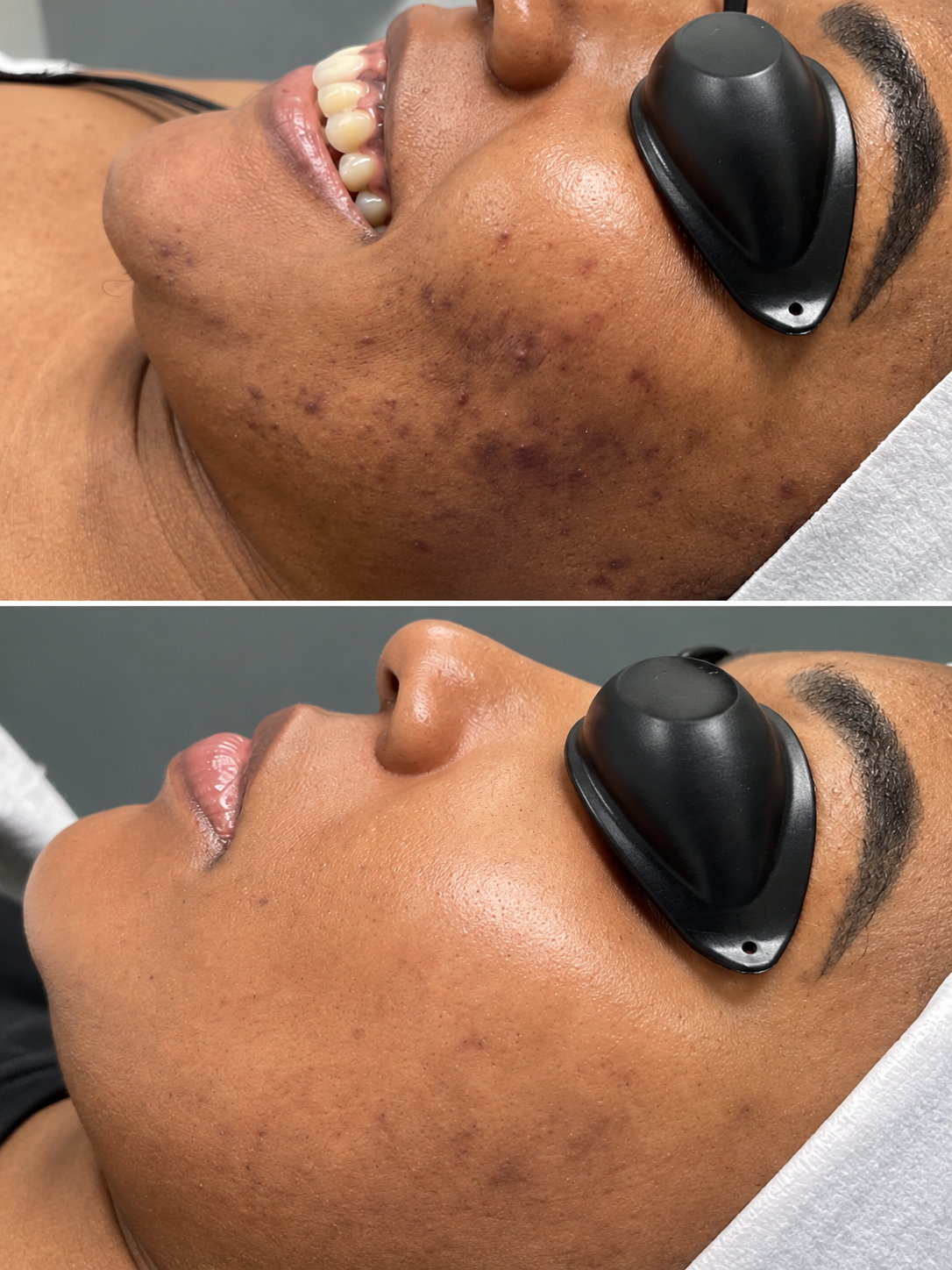 Original client comparison: before and after