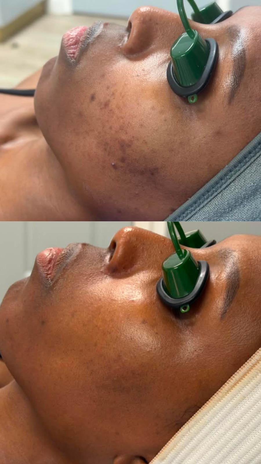 Original client comparison: before and after
