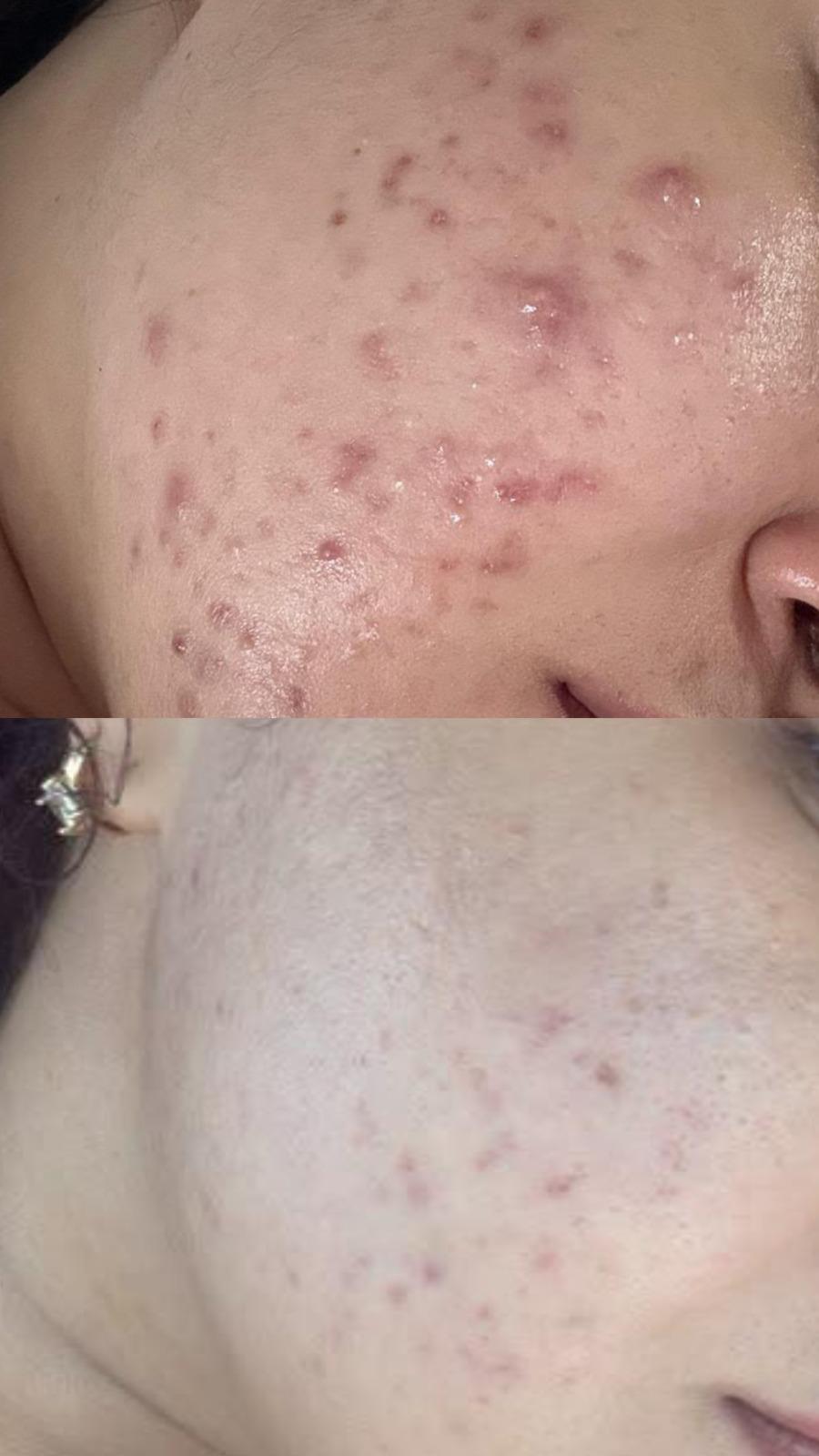 Original client comparison: before and after